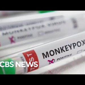 Public effectively being knowledgeable on rising concerns about monkeypox outbreak