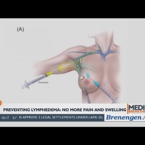 Medical Breakthroughs – Combating Lymphedema