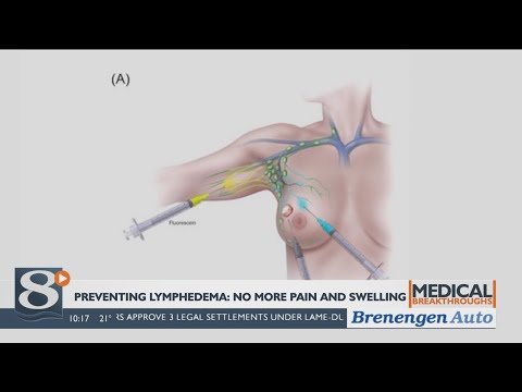 Medical Breakthroughs – Combating Lymphedema