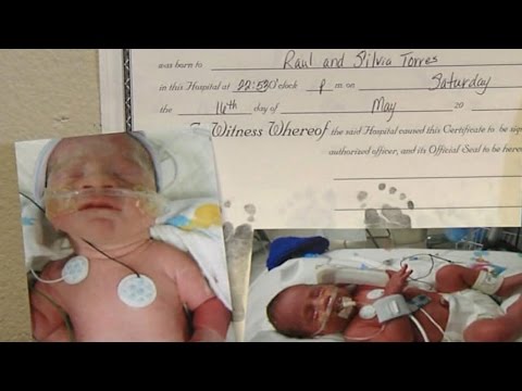 Conjoined Twins Born from Enviornment of Identical Triplets | Exact Morning The United States | ABC News
