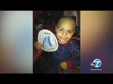 Anthony Avalos loss of life: Pediatrician testifies boy used to be ‘pores and skin and bones’