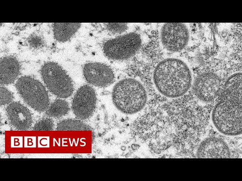 WHO announces best alert over monkeypox outbreak – BBC News