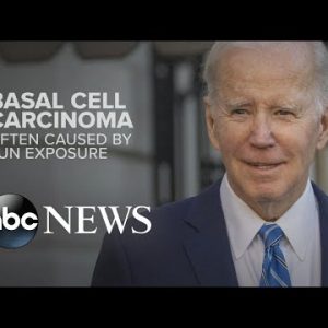 Biden has cancerous skin lesion eliminated | WNT