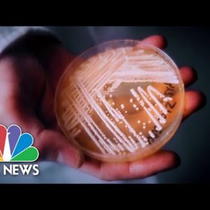 CDC warns unhealthy fungus an infection poses nationwide chance