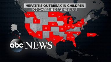 CDC disorders contemporary global alert on hepatitis instances in kids | ABCNL